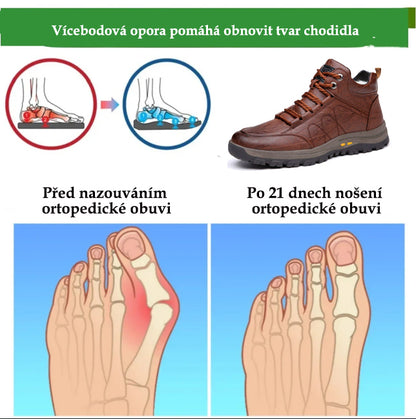 🔥Dnes sleva 50 %, nenechte si to ujít!🐂 Pánská ortopedická obuv je vyrobena z vysoce kvalitní italské hovězí kůže 👞 Ulevuje od bolesti ✅ Pohodlná chůze