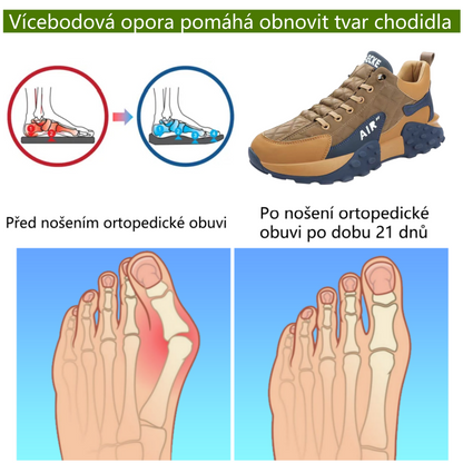 Ortopedická obuv deconr® | Ergonomicky tvarovaná, měkká a pohodlná, zmírňuje únavu nohou po dlouhém dni.