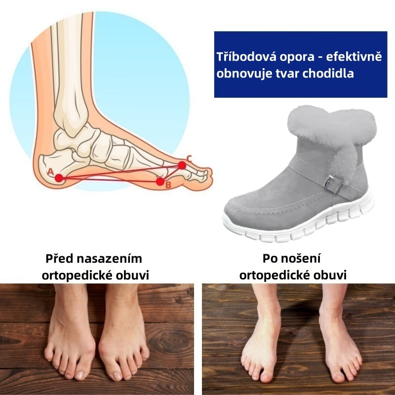 deconr® - Ergonomicky tvarovaná zimní ortopedická obuv pro úlevu od bolesti nohou, kolen a zad - Dámské